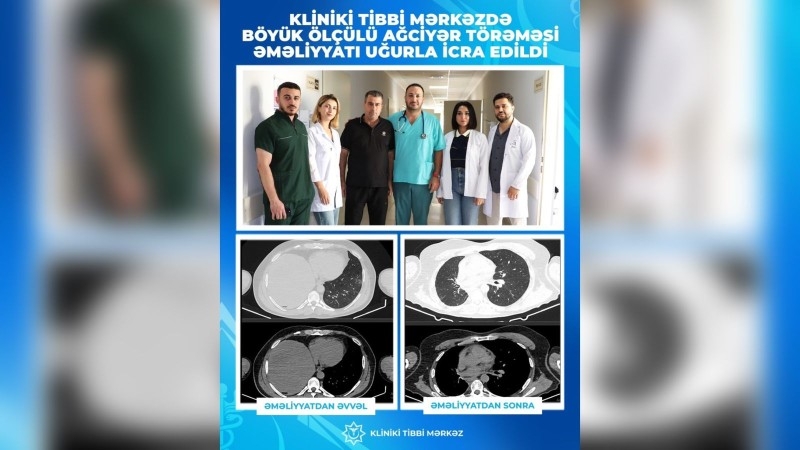 İki uzman həkim əməliyyat etdi, onkoloji xəstə sağaldı 